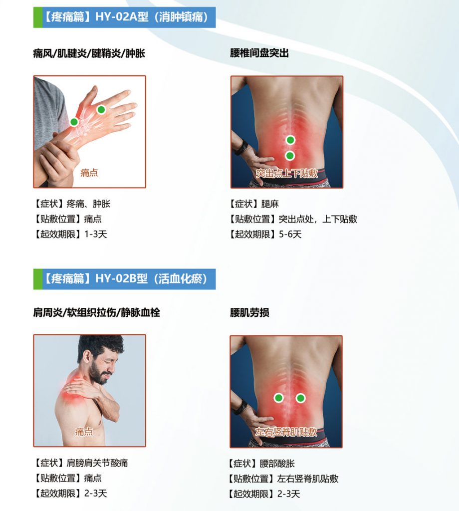 中芯生物一次性使用超声治疗垫片贴敷使用方法图示
