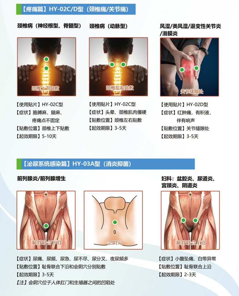 中芯生物一次性使用超声治疗垫片贴敷使用方法图示