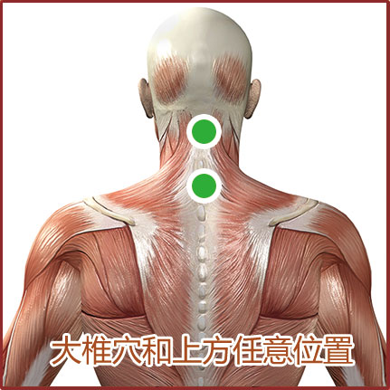 过敏性鼻炎贴敷位置示意图