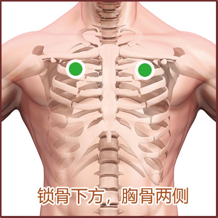 支气管炎/支气管肺炎贴敷位置示意图