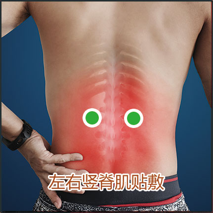 腰肌劳损贴敷位置示意图