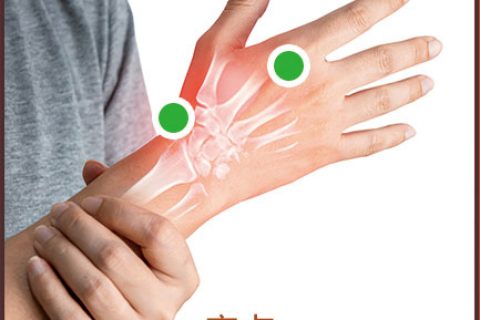 痛风/肌腱炎/腱鞘炎/肿胀等贴敷方法