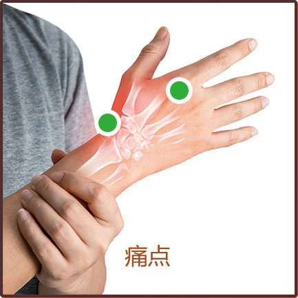 痛风/肌腱炎/腱鞘炎/肿胀等贴敷位置示意图