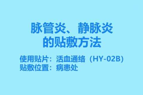 脉管炎、静脉炎的贴敷方法