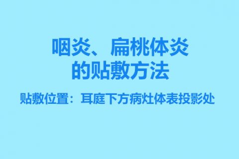 咽炎、扁桃体炎的贴敷方法