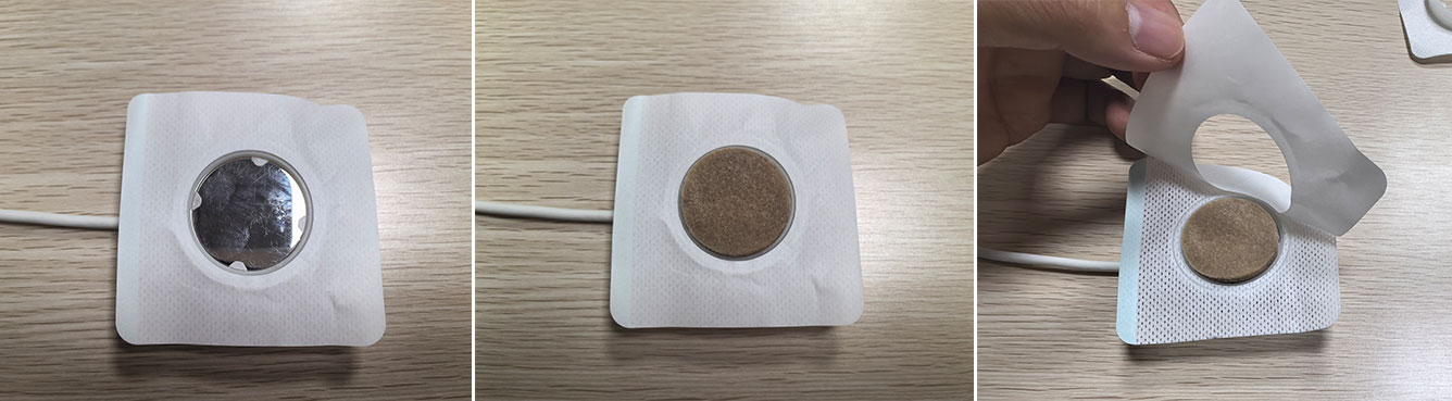 第二步：固定贴与治疗头的安装